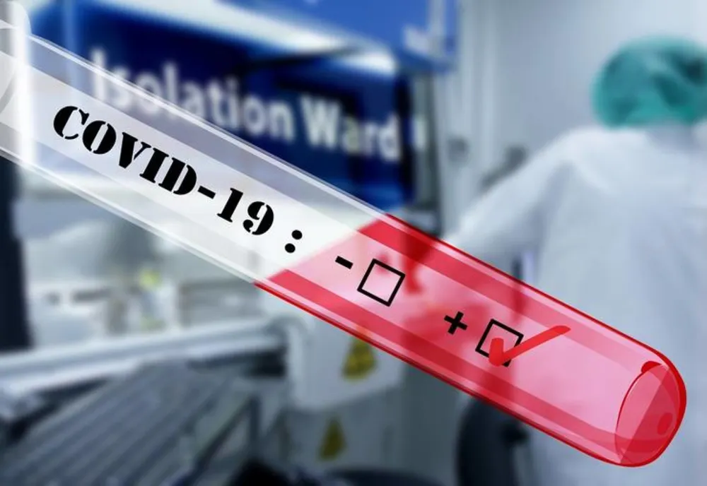 2.460 de cazuri confirmate cu infecție de COVID19. 252 de oameni au fost vindecați și externați