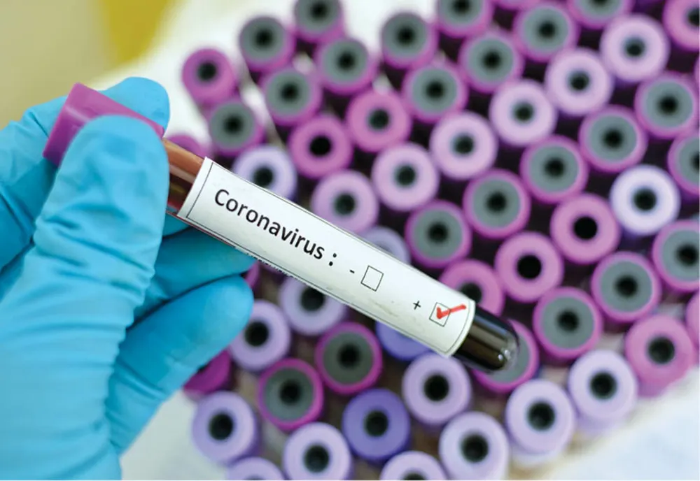 NOU RECORD de infectări cu SARS CoV-2 la nivel național! 83 de români au decedat