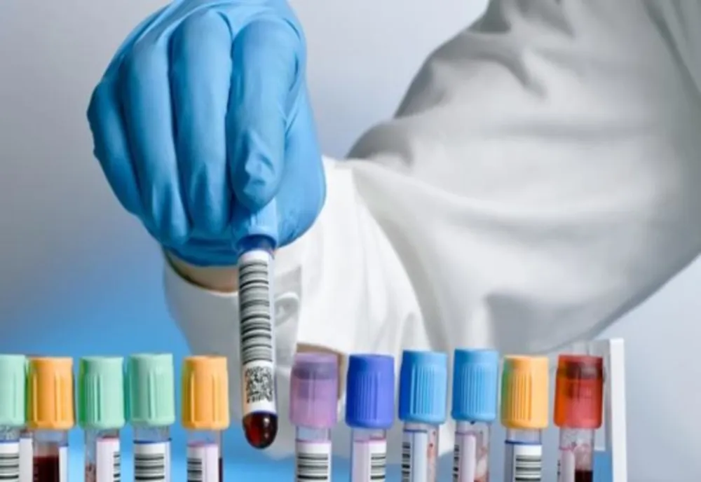 Principalele analize și consulturi medicale necesare pentru monitorizarea stării de sănătate!