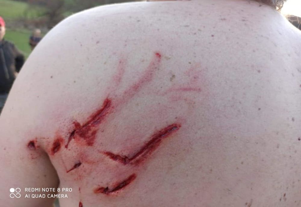 Sâmbătă neagră pe fondurile de vânătoare din Mureș: alt om atacat și rănit de urs