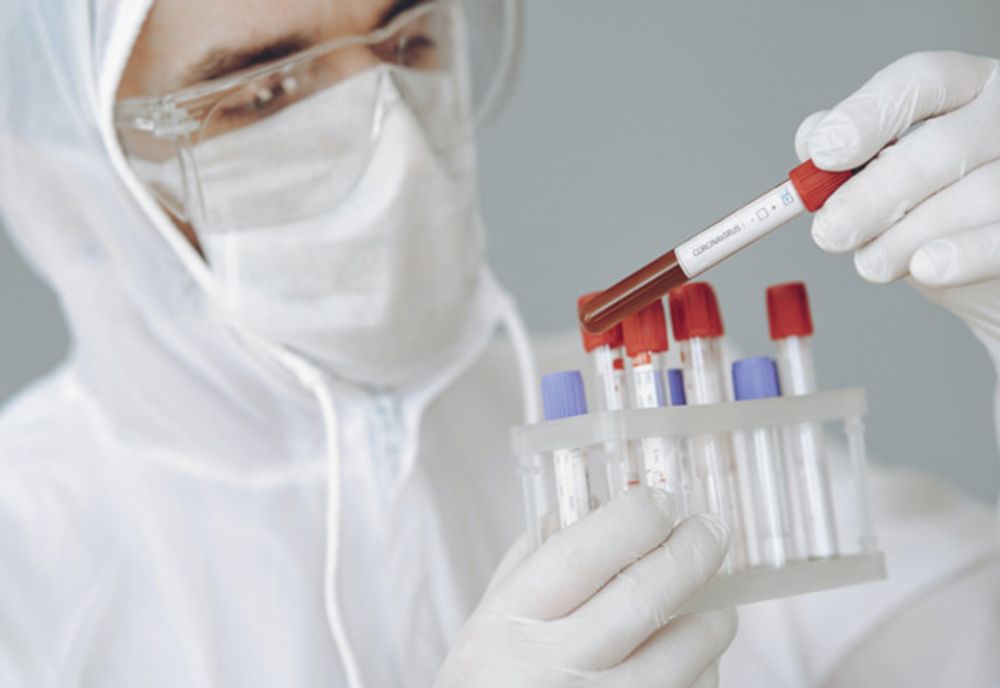 Bilanț CoVid-19, 29 august: 1.365 infectați, 332 vindecați, 32 decedați, 490 internați în ATI! Vezi situația din județul tău