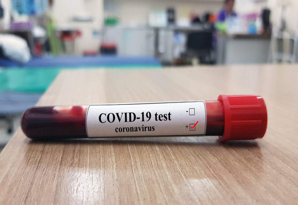 Coronavirus, în Mureș. Situația completă, la ora 13