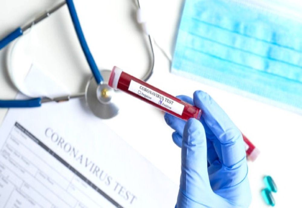 141 de pacienți infectați cu COVID19 sunt internați la ATI